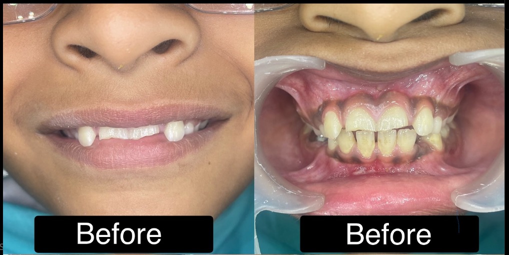 Before treatment