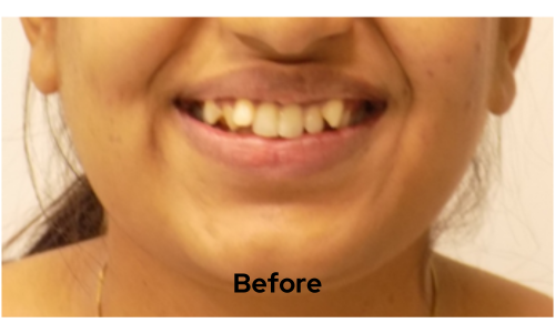 Before treatment